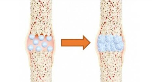 Imagen representativa de Desarrrollan un nanocemento